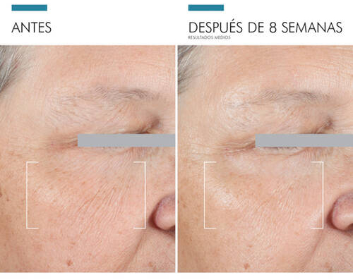 contorno de ojos SkinCeuticals