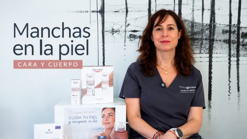 Manchas en la cara y la piel: Cómo tratarlas