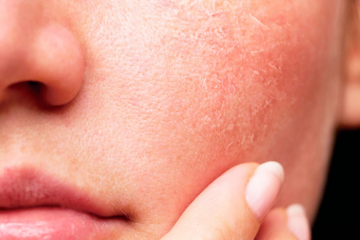 piel seca farmacia romany